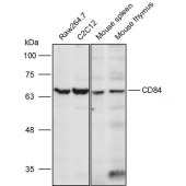 Solarbio K111258P Anti-CD84 Polyclonal Antibody