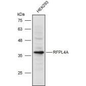 Solarbio K111257P Anti-RFPL4A/RFPL4AL1 Polyclonal Antibody