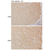 Solarbio K111226P Anti-UPP2 Polyclonal Antibody