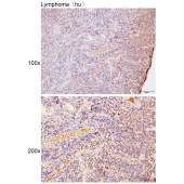 Solarbio K111766P Anti-PBK Polyclonal Antibody