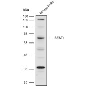 Solarbio K110564P Anti-BEST1 Polyclonal Antibody