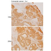 Solarbio K111450P Anti-RPP40 Polyclonal Antibody