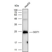 Solarbio K111670P Anti-GGT1 Polyclonal Antibody
