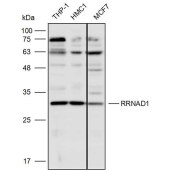 Solarbio K110532P Anti-RRNAD1 Polyclonal Antibody