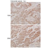 Solarbio K111962P Anti-AVPI1 Polyclonal Antibody