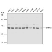 Solarbio K111268P Anti-DAPK2 Polyclonal Antibody