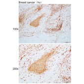 Solarbio K110820P Anti-ARHGAP22 Polyclonal Antibody
