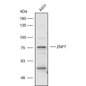 Solarbio K110822P Anti-ZNF7 Polyclonal Antibody