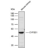 Solarbio K111764P Anti-CYP2E1 Polyclonal Antibody