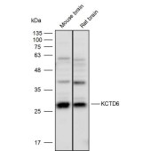 Solarbio K111647P Anti-KCTD6 Polyclonal Antibody