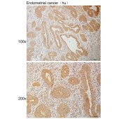 Solarbio K110937P Anti-RPN2 Polyclonal Antibody