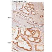 Solarbio K111780P Anti-GPS1 Polyclonal Antibody