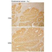 Solarbio K111069P Anti-MID1 Polyclonal Antibody