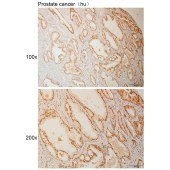 Solarbio K110962P Anti-POGZ Polyclonal Antibody