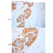 Solarbio K112133P Anti-MGAT1 Polyclonal Antibody