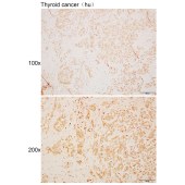 Solarbio K110542P Anti-ALX1 Polyclonal Antibody