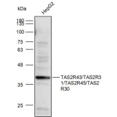 Solarbio K111856P Anti-TAS2R43/TAS2R31/TAS2R45/TAS2R30 Polyclonal Antibody