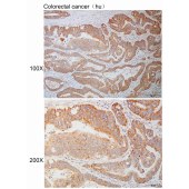 Solarbio K110926P Anti-NDUFA4L2 Polyclonal Antibody