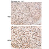 Solarbio K111622P Anti-EIF4EBP1 Polyclonal Antibody