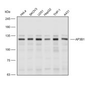 Solarbio K110610P Anti-AP3B1 Polyclonal Antibody