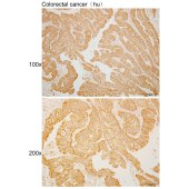 Solarbio K110527P Anti-WDR41 Polyclonal Antibody