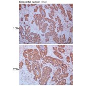 Solarbio K111650P Anti-SGTA Polyclonal Antibody