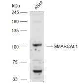 Solarbio K111038P Anti-SMARCAL1 Polyclonal Antibody
