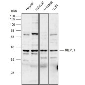 Solarbio K111804P Anti-RILPL1 Polyclonal Antibody
