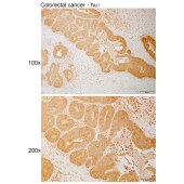 Solarbio K111010P Anti-GTPBP4 Polyclonal Antibody