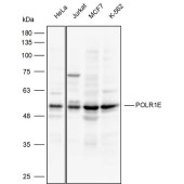 Solarbio K111920P Anti-POLR1E Polyclonal Antibody