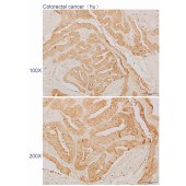 Solarbio K110582P Anti-S100P Polyclonal Antibody