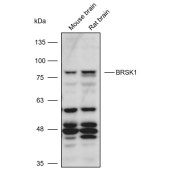 Solarbio K111090P Anti-BRSK1 Polyclonal Antibody