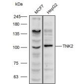 Solarbio K111890P Anti-TNK2 Polyclonal Antibody