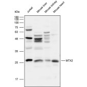 Solarbio K111793P Anti-MTX2 Polyclonal Antibody