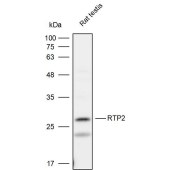 Solarbio K111947P Anti-RTP2 Polyclonal Antibody