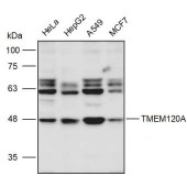 Solarbio K111229P Anti-TMEM120A Polyclonal Antibody