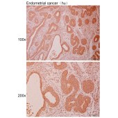 Solarbio K110998P Anti-CABP7 Polyclonal Antibody