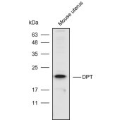 Solarbio K110565P Anti-DPT Polyclonal Antibody