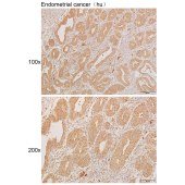 Solarbio K111256P Anti-KCNK1 Polyclonal Antibody
