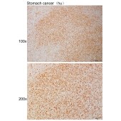 Solarbio K111067P Anti-TCF4 Polyclonal Antibody