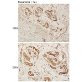 Solarbio K111461P Anti-KLHL32 Polyclonal Antibody