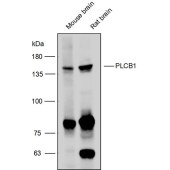 Solarbio K111744P Anti-PLCB1 Polyclonal Antibody