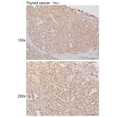 Solarbio K111631P Anti-BIN1 Polyclonal Antibody