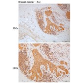 Solarbio K111789P Anti-NAA40 Polyclonal Antibody
