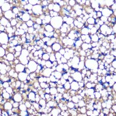 Solarbio K009922M Anti-Perilipin A Monoclonal Antibody