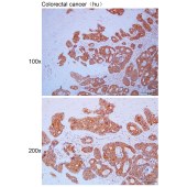 Solarbio K111648P Anti-FARSB Polyclonal Antibody