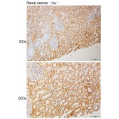 Solarbio K111095P Anti-ATXN1 Polyclonal Antibody