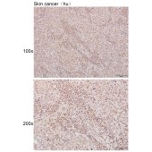 Solarbio K111050P Anti-NFIL3 Polyclonal Antibody