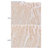 Solarbio K110580P Anti-ABI3BP Polyclonal Antibody