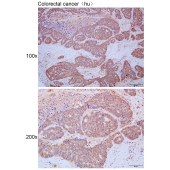 Solarbio K111497P Anti-VAV1 Polyclonal Antibody